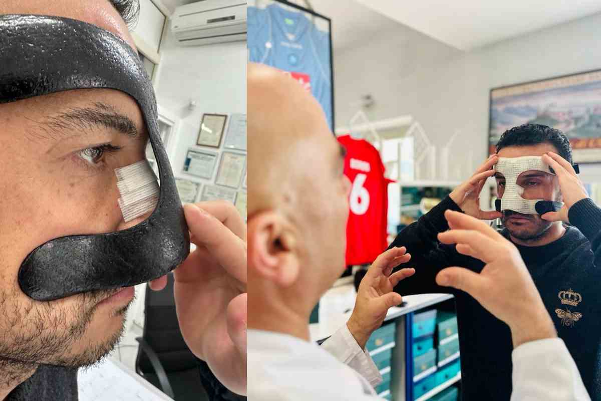 Lazio, la maschera di Pedro per giocare